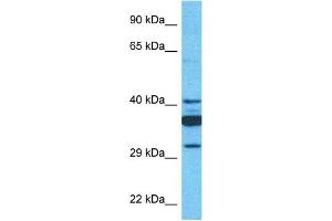 Host:  Rabbit  Target Name:  SLC35C1  Sample Type:  721_B Whole Cell lysates  Antibody Dilution:  1. (SLC35C1 anticorps  (C-Term))