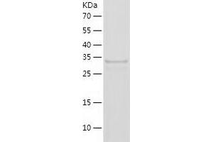 Western Blotting (WB) image for Neuromedin B (AA 25-121) protein (His-IF2DI Tag) (ABIN7124152) (Neuromedin B Protein (AA 25-121) (His-IF2DI Tag))