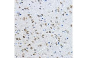 Immunohistochemistry of paraffin-embedded mouse brain using [KO Validated] NeuN Rabbit pAb (ABIN3021158, ABIN3021159, ABIN1513254, ABIN1514400 and ABIN6214040) at dilution of 1:100 (40x lens). (NeuN anticorps  (AA 1-220))