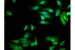 Immunofluorescence staining of Hela cells with ABIN7149997 at 1:100, counter-stained with DAPI.