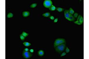 Immunofluorescent analysis of PC-3 cells using ABIN7163117 at dilution of 1:100 and Alexa Fluor 488-congugated AffiniPure Goat Anti-Rabbit IgG(H+L) (TAM41 anticorps  (AA 161-452))