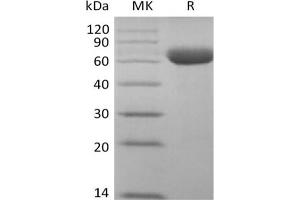 Western Blotting (WB) image for Sialic Acid Binding Ig-Like Lectin 15 (SIGLEC15) (Active) protein (Fc Tag) (ABIN7321036)