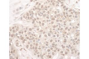 anti-Eyes Absent Homolog 2 (Drosophila) (EYA2) (AA 100-150) antibody