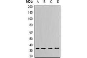 Western blot analysis of CapZ alpha-2 expression in Hela (A), THP1 (B), mouse brain (C), mouse heart (D) whole cell lysates. (CAPZA2 anticorps)