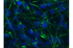 Image no. 1 for anti-Nestin (NES) antibody (ABIN335378) (Nestin anticorps)