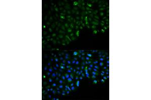 Immunofluorescence analysis of U2OS cell using HK2 antibody. (Hexokinase 2 anticorps)