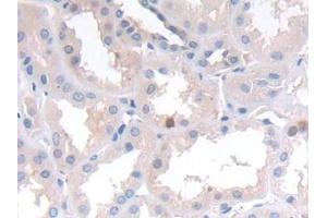 Detection of NCAD in Human Kidney Tissue using Polyclonal Antibody to N-cadherin (NCAD)