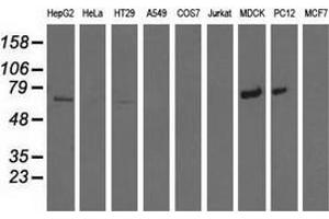 Western blot analysis of extracts (35 µg) from 9 different cell lines by using anti-MTMR14 monoclonal antibody. (MTMR14 anticorps)