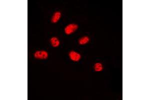 Immunofluorescent analysis of NET (pS357) staining in HUVEC cells. (ELK3 anticorps  (C-Term, pSer357))