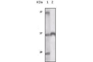 Western blot analysis using TYRO3 mouse mAb against truncated TYRO3 recombinant protein. (TYRO3 anticorps)