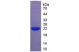 SDS-PAGE analysis of Human Interleukin 1 zeta Protein. (IL-37 Protéine)