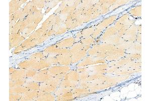 ABIN6255205 and ABIN6267091 at 1/100 staining Rat skin tissue by IHC-P. (TBC1D4 anticorps  (pSer318))