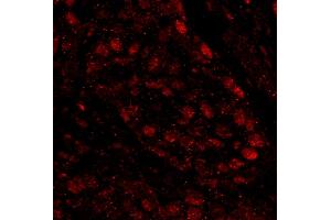 Immunofluorescence (IF) image for anti-Poly (ADP-Ribose) Polymerase 1 (PARP1) (AA 50-100) antibody (ABIN7448996) (PARP1 anticorps  (AA 50-100))