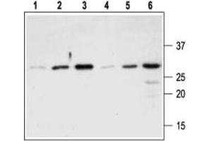 Western blot analysis of Recombinant mouse proNGF protein (#N-250), (lanes 1-3) and Recombinant human proNGF protein (#N-280), (lanes 4-6): - 1,4.