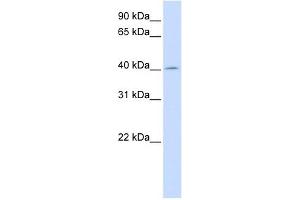 ACAA2 antibody used at 1 ug/ml to detect target protein. (ACAA2 anticorps  (N-Term))