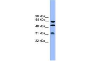 Image no. 1 for anti-serpin Peptidase Inhibitor, Clade A (Alpha-1 Antiproteinase, Antitrypsin), Member 4 (SERPINA4) (AA 271-320) antibody (ABIN6745377) (SERPINA4 anticorps  (AA 271-320))