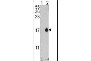 Western blot analysis of P1LC3B (arrow) using rabbit polyclonal G8b (P1LC3B) Antibody (T6) 1802d.