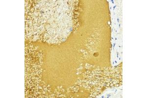 anti-Insulin-Like Growth Factor 1 (IGF1) (AA 50-150) antibody