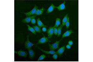 IF analysis of AS160/TBC1D4 using anti-AS160/TBC1D4 antibody (ABIN7599745). (TBC1D4 anticorps  (AA 1118-1298))