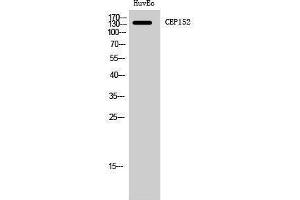 Western Blotting (WB) image for anti-Centrosomal Protein 152kDa (CEP152) (Internal Region) antibody (ABIN3174341) (CEP152 anticorps  (Internal Region))