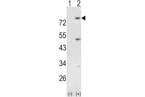 Western Blotting (WB) image for anti-Phosphoinositide-3-Kinase, Regulatory Subunit 5 (PIK3R5) antibody (ABIN3003638) (PIK3R5 anticorps)