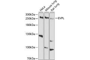 Western blot analysis of extracts of various cell lines, using EVPL antibody (ABIN6129811, ABIN6140350, ABIN6140351 and ABIN6214378) at 1:1000 dilution. (Envoplakin anticorps  (AA 1784-2033))