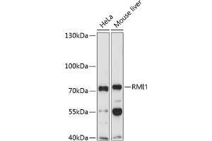 Western blot analysis of extracts of various cell lines, using RMI1 Antibody (ABIN1682540, ABIN3019316, ABIN3019317, ABIN5664937 and ABIN6220821) at 1:1000 dilution.