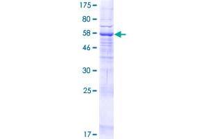 Image no. 1 for Membrane Bound O-Acyltransferase Domain Containing 2 (MBOAT2) (AA 1-350) protein (GST tag) (ABIN1310493)