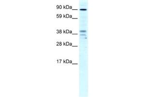 Western Blotting (WB) image for anti-Zinc Finger CCCH-Type Containing 7B (ZC3H7B) antibody (ABIN2460487)