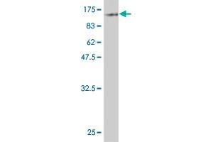 Western Blot detection against Immunogen (88. (ZYX anticorps  (AA 1-572))