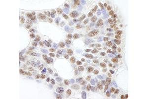 Immunohistochemistry (IHC) image for anti-Ubiquitin Specific Peptidase 47 (USP47) (C-Term) antibody (ABIN7449031) (USP47 anticorps  (C-Term))
