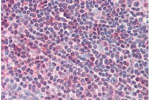 Human Tonsil (formalin-fixed, paraffin-embedded) stained with CENTB1 antibody ABIN337010 at 5 ug/ml followed by biotinylated anti-goat IgG secondary antibody ABIN481715, alkaline phosphatase-streptavidin and chromogen. (ACAP1 anticorps  (AA 728-740))