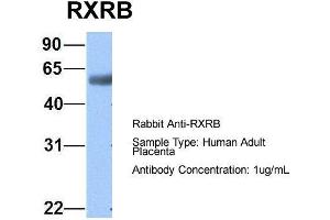 Host:  Rabbit  Target Name:  RXRB  Sample Type:  Human Adult Placenta  Antibody Dilution:  1. (Retinoid X Receptor beta anticorps  (N-Term))