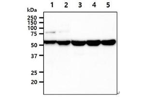 The cell lysates (40ug) were resolved by SDS-PAGE, transferred to PVDF membrane and probed with anti-human UGDH antibody (1:1000). (UGDH anticorps)