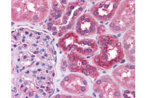 Immunohistochemistry (IHC) image for anti-Signal Transducer and Activator of Transcription 6, Interleukin-4 Induced (STAT6) (C-Term) antibody (ABIN2777200)