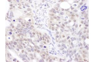 Immunohistochemistry (IHC) image for anti-Coilin (COIL) (AA 526-576) antibody (ABIN7454957)