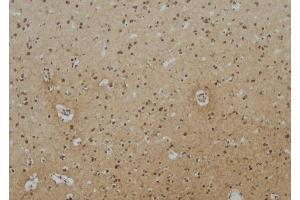 ABIN6275114 at 1/100 staining Human brain tissue by IHC-P.