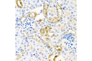 Immunohistochemistry of paraffin-embedded mouse kidney using CST4 antibody at dilution of 1:100 (40x lens). (CST4 anticorps)