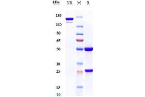 Anti-AXL / UFO Reference Antibody (tilvestamab) on SDS-PAGE under reducing (R) condition.