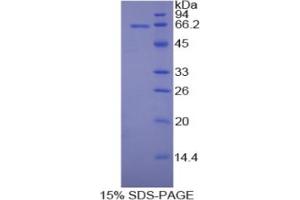 SDS-PAGE analysis of Rat MAP2 Protein. (MAP2 Protéine)