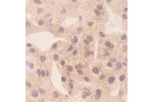 Immunohistochemistry (IHC) image for anti-Chemokine (C-X-C Motif) Ligand 10 (CXCL10) antibody (ABIN1854144)