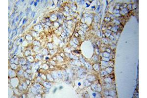 Immunohistochemistry (IHC) image for anti-ATG5 Autophagy Related 5 (ATG5) (AA 1-275) antibody (ABIN3020674) (ATG5 anticorps  (AA 1-275))