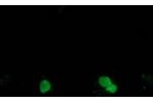 Image no. 1 for anti-Synovial Sarcoma, X Breakpoint 1 (SSX1) antibody (ABIN1501158) (SSX1 anticorps)