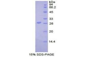 SDS-PAGE (SDS) image for Ubiquitin Carboxyl-terminal Hydrolase L5 (UCHL5) (AA 27-246) protein (His tag) (ABIN1877547)