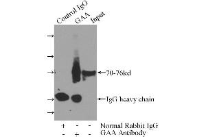 IP analysis of mouse liver tissue lysate (4000 μg), using GAA antibody (4 μg, 1/600 dilution).