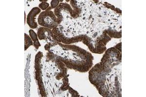 Immunohistochemical staining of human placenta with YIPF2 polyclonal antibody  shows strong cytoplasmic positivity in trophoblastic at 1:50-1:200 dilution. (YIPF2 anticorps)