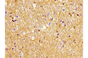 Immunohistochemistry of paraffin-embedded human brain tissue using ABIN7152234 at dilution of 1:100