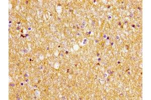 Immunohistochemistry of paraffin-embedded human brain tissue using ABIN7152234 at dilution of 1:100 (SLC1A2 anticorps  (AA 460-574))