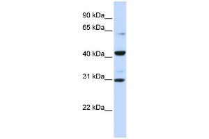 WB Suggested Anti-ZNF193 Antibody Titration:  0. (Zinc Finger and SCAN Domain Containing 9 (ZSCAN9) (Middle Region) anticorps)