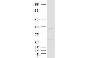 Validation with Western Blot